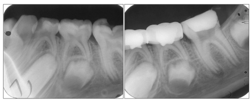 Figure1